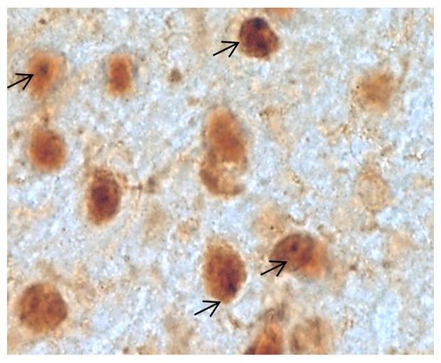 Mouse brain with htt aggregates signaled by the arrows (Dr. David Rubinsztein)