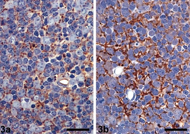 Scrapie_lymph_node_immunoglobulin_labeling